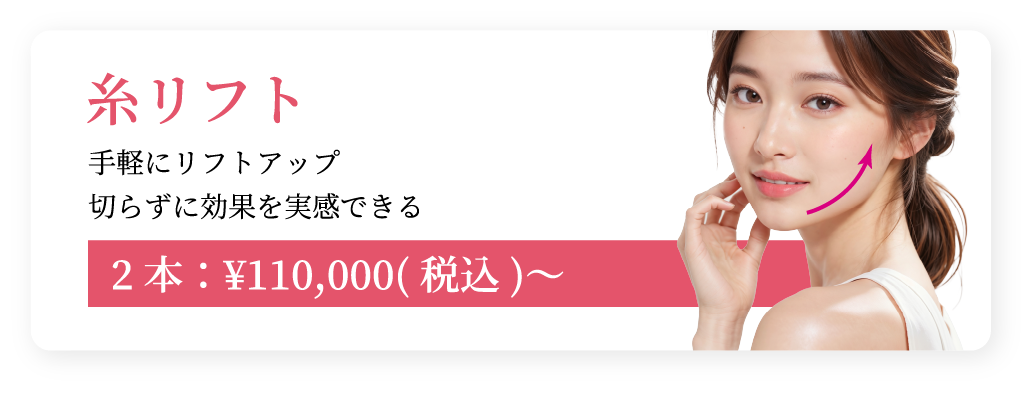 糸リフト