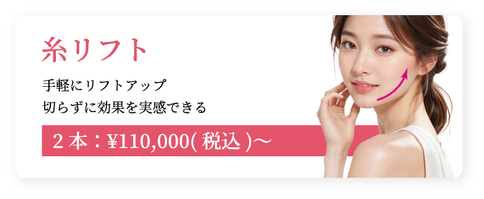 糸リフト