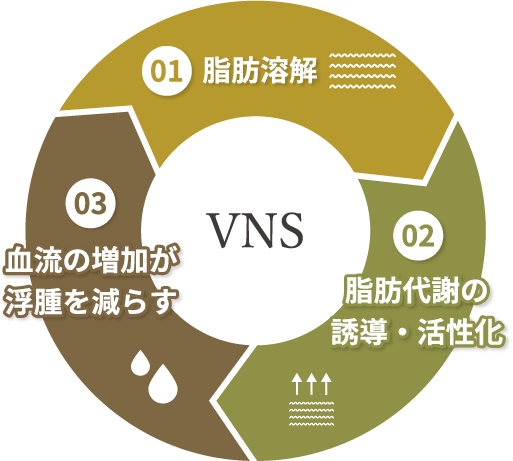 VNS