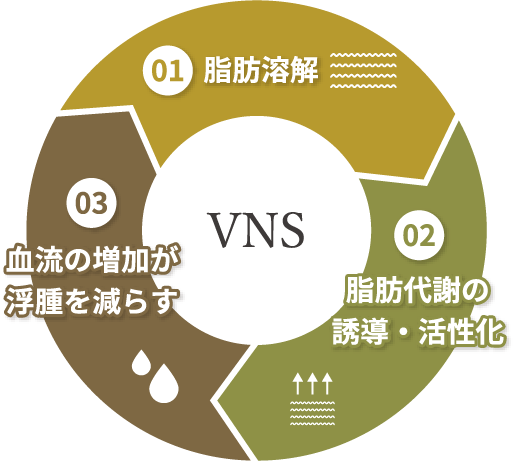 VNS
