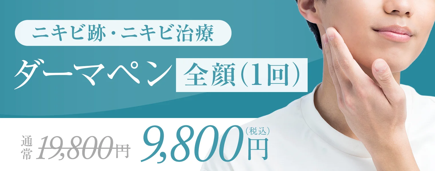 ニキビ跡・ニキビ治療 ダーマペン・全顔・1回 通常料金¥19,800 → 9,800円